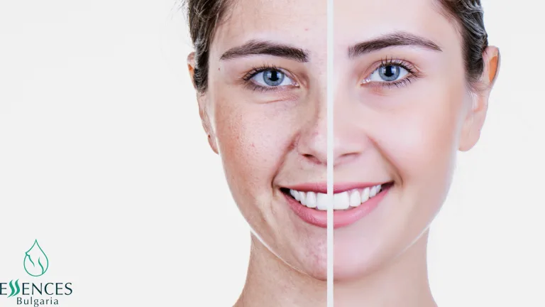 Bei problematischer Haut: Produkte mit entzündungshemmender Wirkung